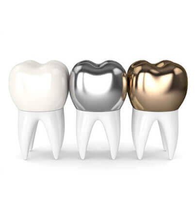 CAD-CAM-Based-Practices