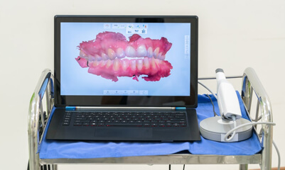 ConeBeam CT imaging Oklahoma City OK - Royal Oak Family Dental