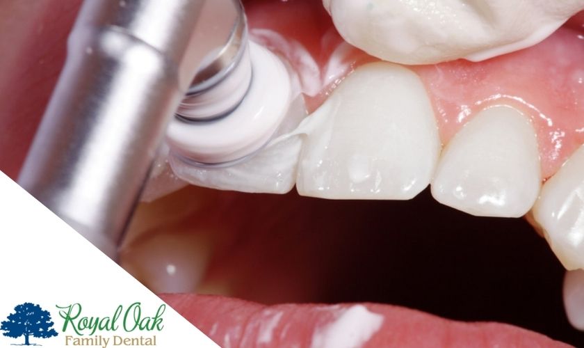 Royal Oak Family Dental – Teeth Cleaning