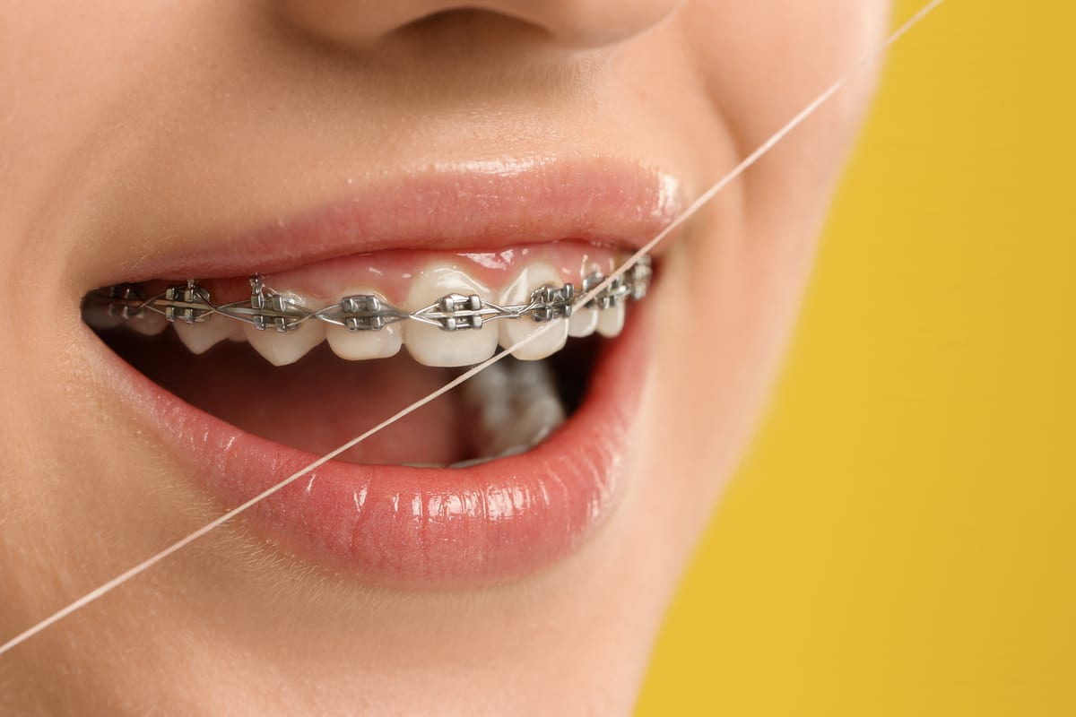 orthodontics-oklahoma-city-1791816128279